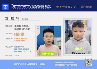支皓轩·单眼显性外斜1个月达标✅️