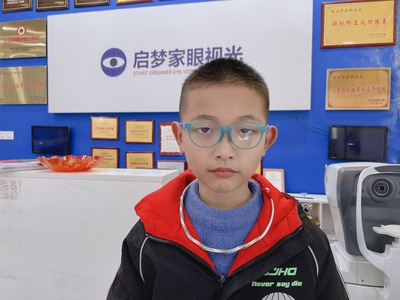 姓名：游聪聪     
屈光性质：远视+散光→中度弱视
精准屈光度：
右眼：+0.50/+1.00*10→0.5
左眼：+0.50/+1.00*110→0.5
电脑矫正视力
右眼: 1.0✅   左眼:1.0✅
5M矫正视力
右眼: 1.0✅ 左眼:1.0✅
视力情况： 中度弱视，购买了设备，定期在店复查，矫正花了三年时间达到医学标准1.0