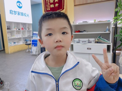 姓名：陈渝涵
屈光性质：单纯性屈光不正散光
精准屈光度：
右眼：1.2-
左眼：一0.75X160一>1.0（裸眼0.6）
视力情况：
电脑矫正视力
右眼:2.0-4✅      左眼:1.2-3✅
5M矫正视力
右眼: 1.5-2✅   左眼:   1.0-✅
视力情况：   视力提升的非常不错。
