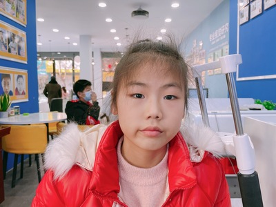 姓名：龚欣
屈光性质：屈光不正散光
精准屈光度：
右眼：-0.50*5→1.0（裸眼0.7）
左眼：-0.25*10→1.0（裸眼0.8）
电脑矫正视力
右眼: 1.0✅   左眼:1.2✅
5M矫正视力
右眼: 1.2✅ 左眼:1.2✅
视力情况：散光矫正，七天小疗程，双眼均达到1.2的好视力。保持下去，不用戴镜，视力OK