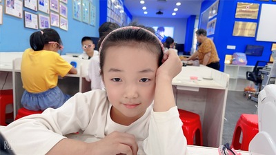 姓名：杨梦
屈光性质：单纯性屈光不正散光
精准屈光度：
右眼：-0.50/-0.50×180   ( 裸眼：0.8 )
左眼：-1.00 ( 裸眼：0.5+2 )
视力情况：
电脑矫正视力
右眼:1.2-3✅      左眼:1.2-3✅
5M矫正视力
右眼: 1.2-3✅   左眼:   1.0✅
视力情况： 散光引起的视力下降及时矫正，恢复到裸眼视力达到正常人的1.0的视力，一个7天小疗程的时间，就成功矫正，这种眼睛很好矫正，但如果散光造成视力偏低诱发了近视及近视涨度这种情况，就矫正不了了，所以定期检查，及时矫正，效果很不错~